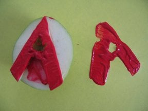 A1