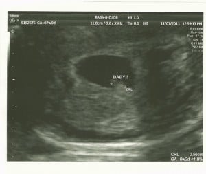 ultrasound image