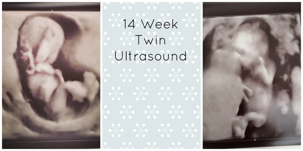 14 week twin ultrasound